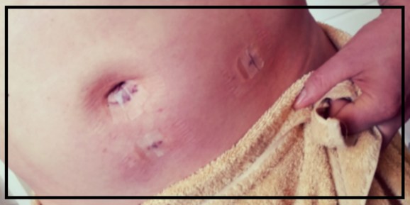 All Better Soon, Belly